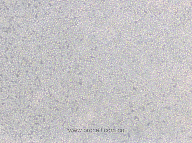 6T-CEM (人T細胞白血病細胞) (STR鑒定正確)