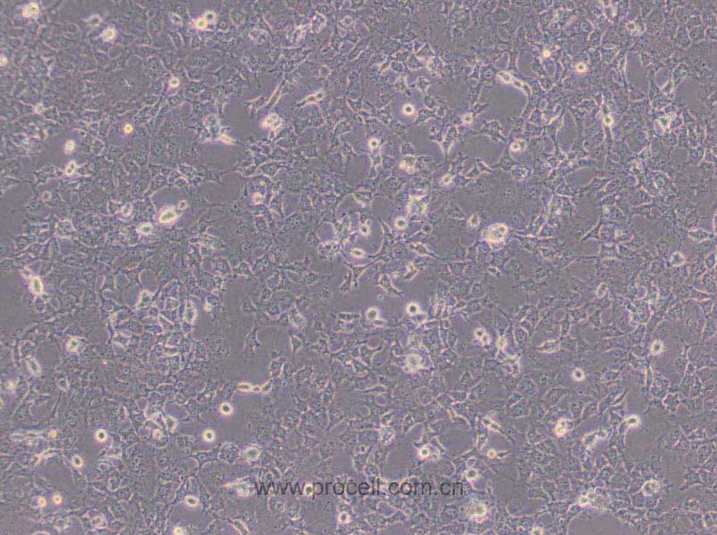 COS-7 (非洲綠猴SV40轉(zhuǎn)化的腎細胞)