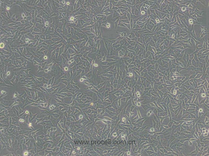 HEp-2 (人喉表皮樣癌細(xì)胞) (Hela污染細(xì)胞系，暫不供應(yīng))