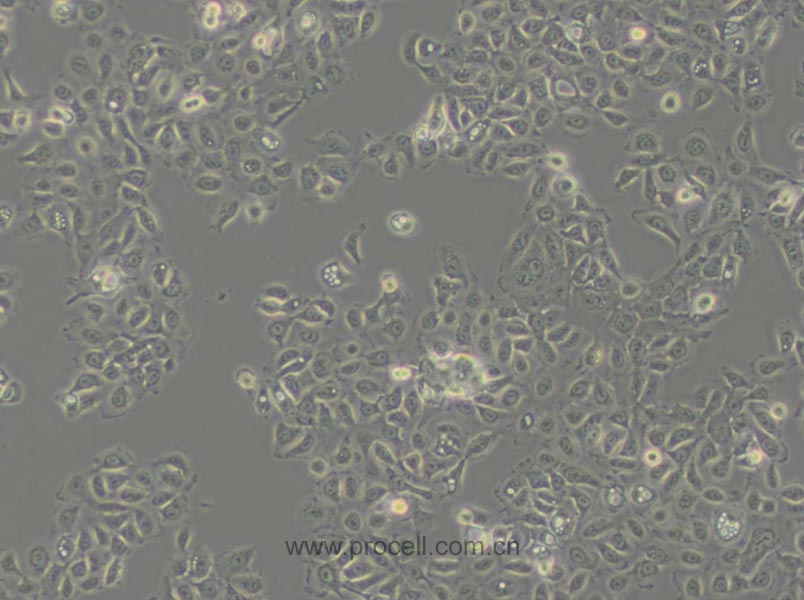 NCI-H292 (人肺癌細胞(淋巴結轉移)) (STR鑒定正確)