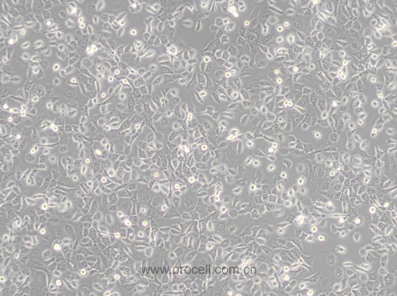 HCC 94 [HCC941122] (人子宮鱗癌細胞(高分化)) (STR鑒定正確)