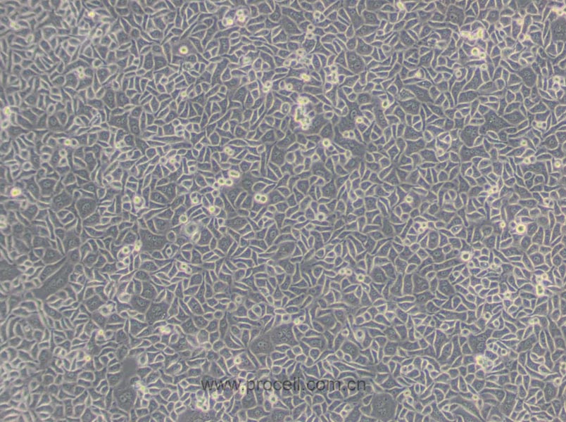 Chang liver (人張氏肝細(xì)胞) (Hela污染細(xì)胞系，暫不供應(yīng))