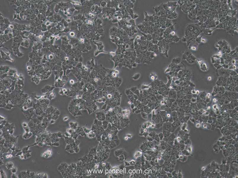 NCI-H1573 (人肺癌腺癌細胞) (STR鑒定正確)