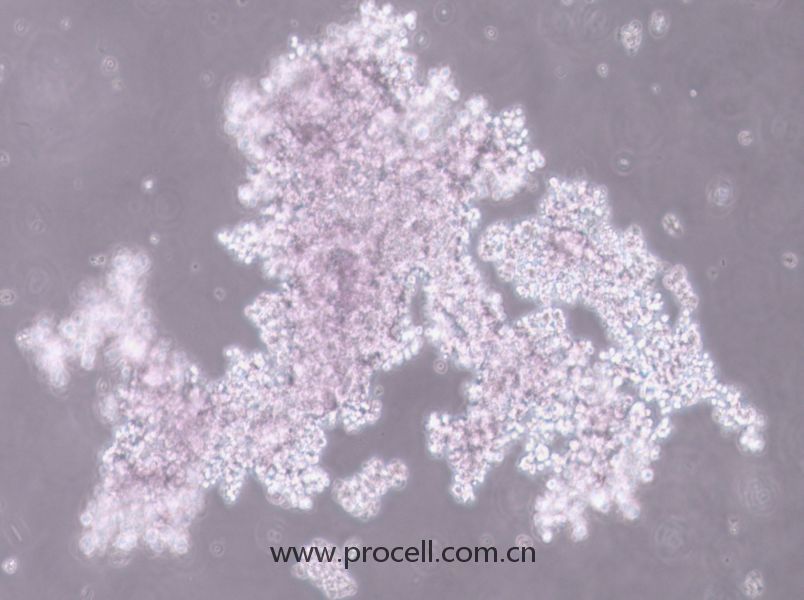 NCI-H660 (人神經(jīng)內分泌前列腺癌細胞) (STR鑒定正確)