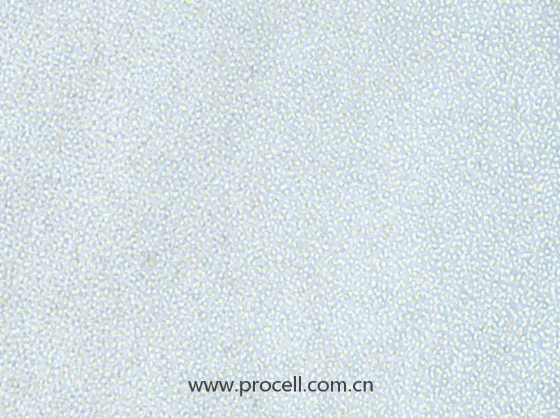 OCI-AML-2 (人急性髓性白血病細(xì)胞) (STR鑒定正確)