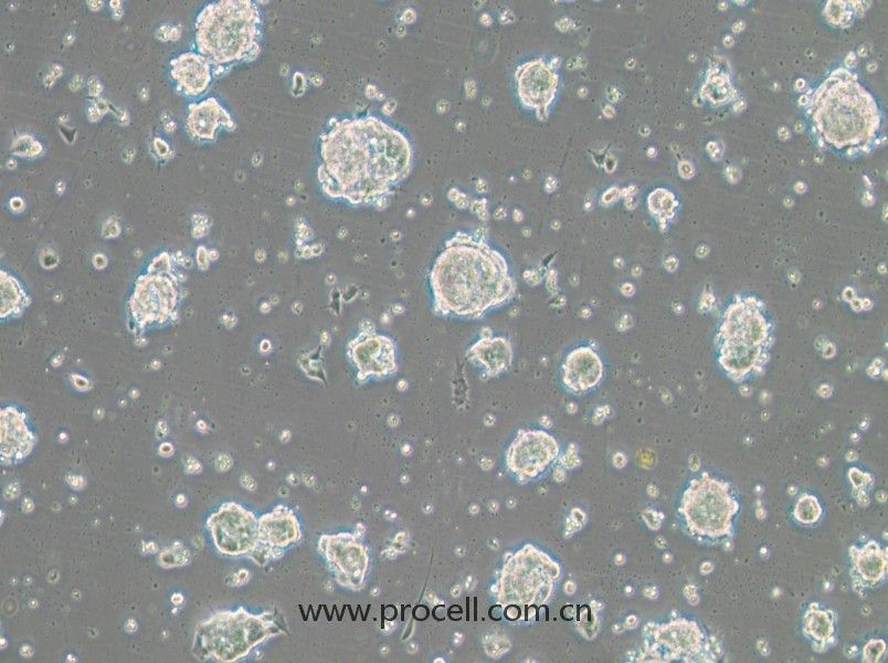 SK-ES-1（人骨肉瘤細胞）（STR鑒定正確）